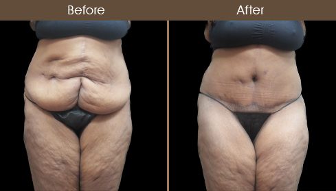 20202705180747_B44-Front